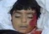 Abu Bakar, 5, killed by ISAF in Kandahar (March 13, 2011)