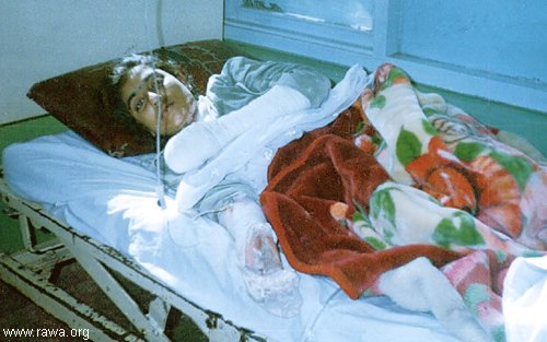 Muska a victim in so-called liberated Afghanistan