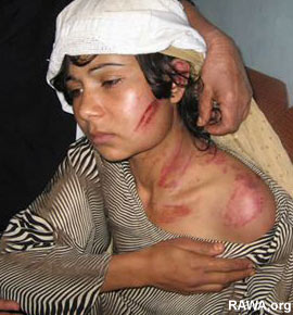 Afghan woman victim of violence