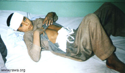 Wounded child in Jalalabad