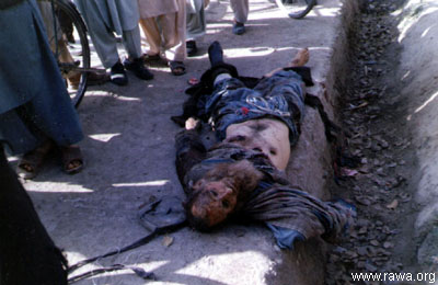 Wounded child in Jalalabad