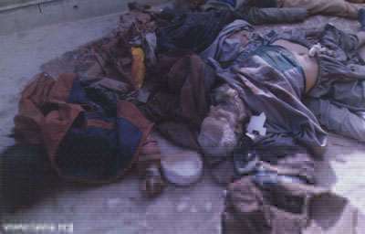 Wounded child in Jalalabad