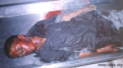 Victim in Jalalabad