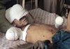 14-years old boy from Agam district in Jalalabad, a victim of the US bombs in Jalalabad (December 3, 2001)