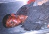 12-years old Sharif Jan s/o Muhammadullah was killed due to an explosion caused by unexploded cluster bomblet in Hada Farm in Jalalabad (October 22, 2002)