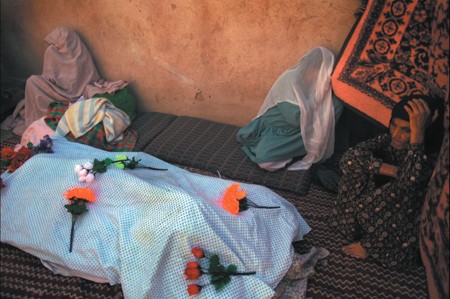 Self-Burning Among Afghan Women