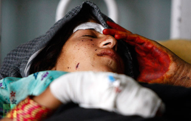 A wounded woman rests at a hospital after NATO air strikes in Laghman province
