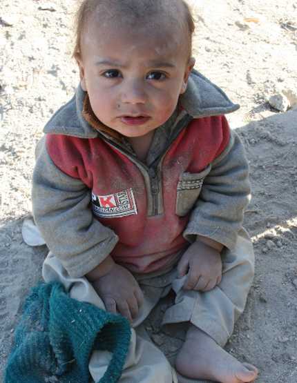 Malnourised children in IDP camp