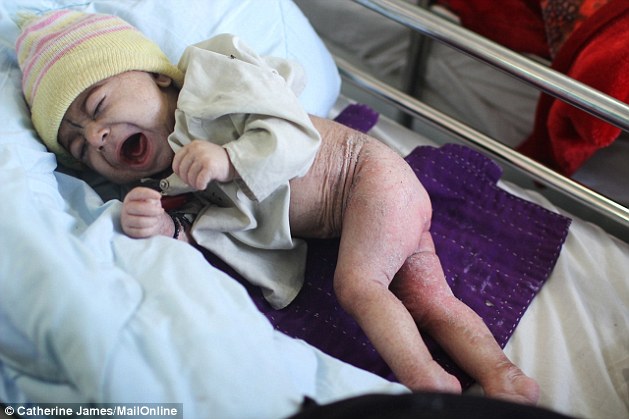 Ehsanullah, aged nine months, has lost his mother because the insurgency meant she could not be treated properly