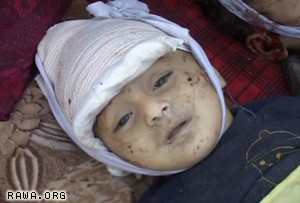 An Afghan child killed by US troops in Kabul on Sep.1, 2008