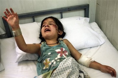 An Afghan child wounded in a suicide attack near the Indian Embassy in central Kabul