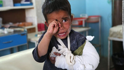 A wounded child cries after receiving treatment at a hospital following an attack in Ghazni province