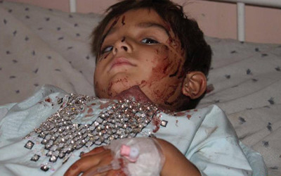 A wounded child receives treatment at a hospital in Kandahar, Afghanistan