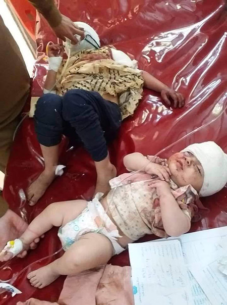 kids and women are killed in bomb blast