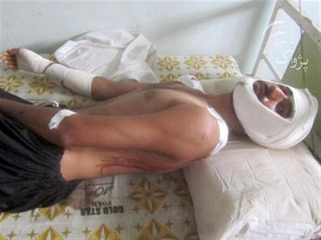 Boy injured in foreign airstrike