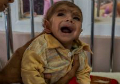 Child Malnutrition Mounts in Afghan Province