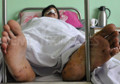 Kabul hospital is sad symbol of Afghanistan’s rising civilian toll