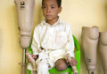 Child’s legs blown off in Kandahar blast