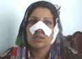 Nose and ear of Nafisa was cut off by her husband (with photos)