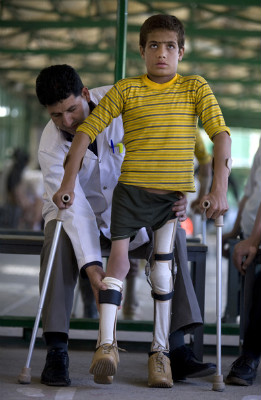 Fawad Rahmani, 11, wears his brand new pair of braces fitted from the ICRC Orthopedic clinic on September 25, 2009 in Kabul, Afghanistan.