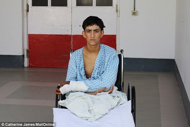 Razimamud, 17, lost his legs and injured his right side after stepping on an improvised explosive device