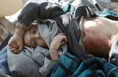 Afghan boy Sayd Rahman, 7, who was shot in crossfire near the Taliban stronghold of Marjah.