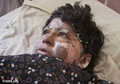 Afghan bride burns herself in protest of domestic violence