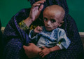 Afghanistan’s Worsening, and Baffling, Hunger Crisis