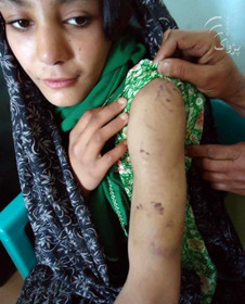 Violence against Afghan women on rise