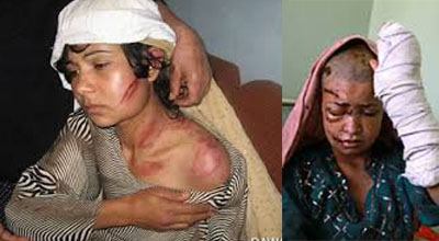 Violence against women in Afganistan