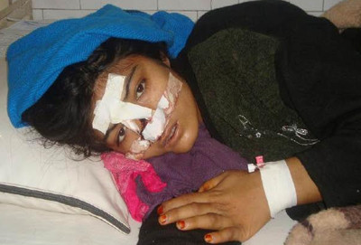 This 15-year old girl lost her life in a hospital in Kabul after her husband beat her mercilessly