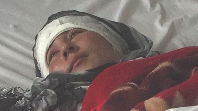 Zarina domestic abuse victim in Mazar, Afghanistan whose ears were cut off by her husband